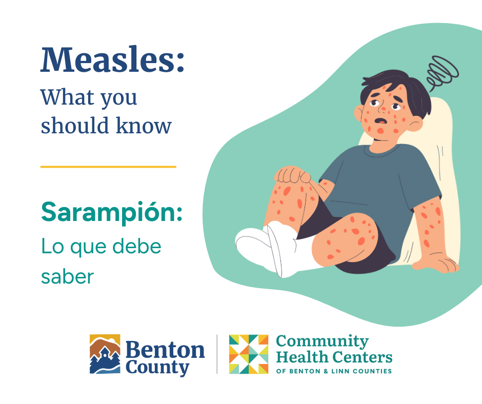 Illustration of a child with measles rash on arms and legs, accompanied by bilingual text about measles awareness from Benton County and Community Health Centers.