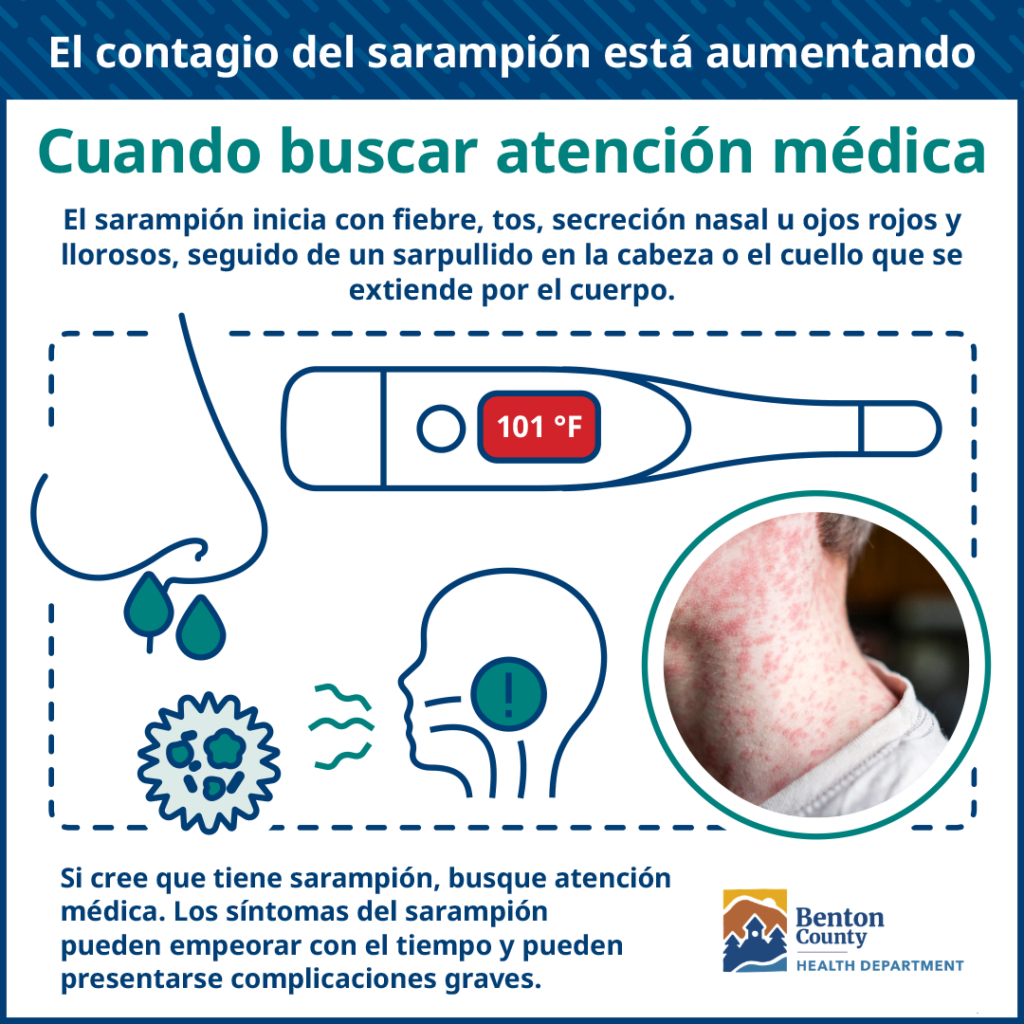 Ilustración que muestra los síntomas del sarampión: fiebre arriba de 101°F, tos, escurrimiento de la nariz, ojos rojos y llorosos y sarpullido o ronchas que se extiende por el cuello y el cuerpo.